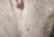 母豬屁股長(zhǎng)膿包